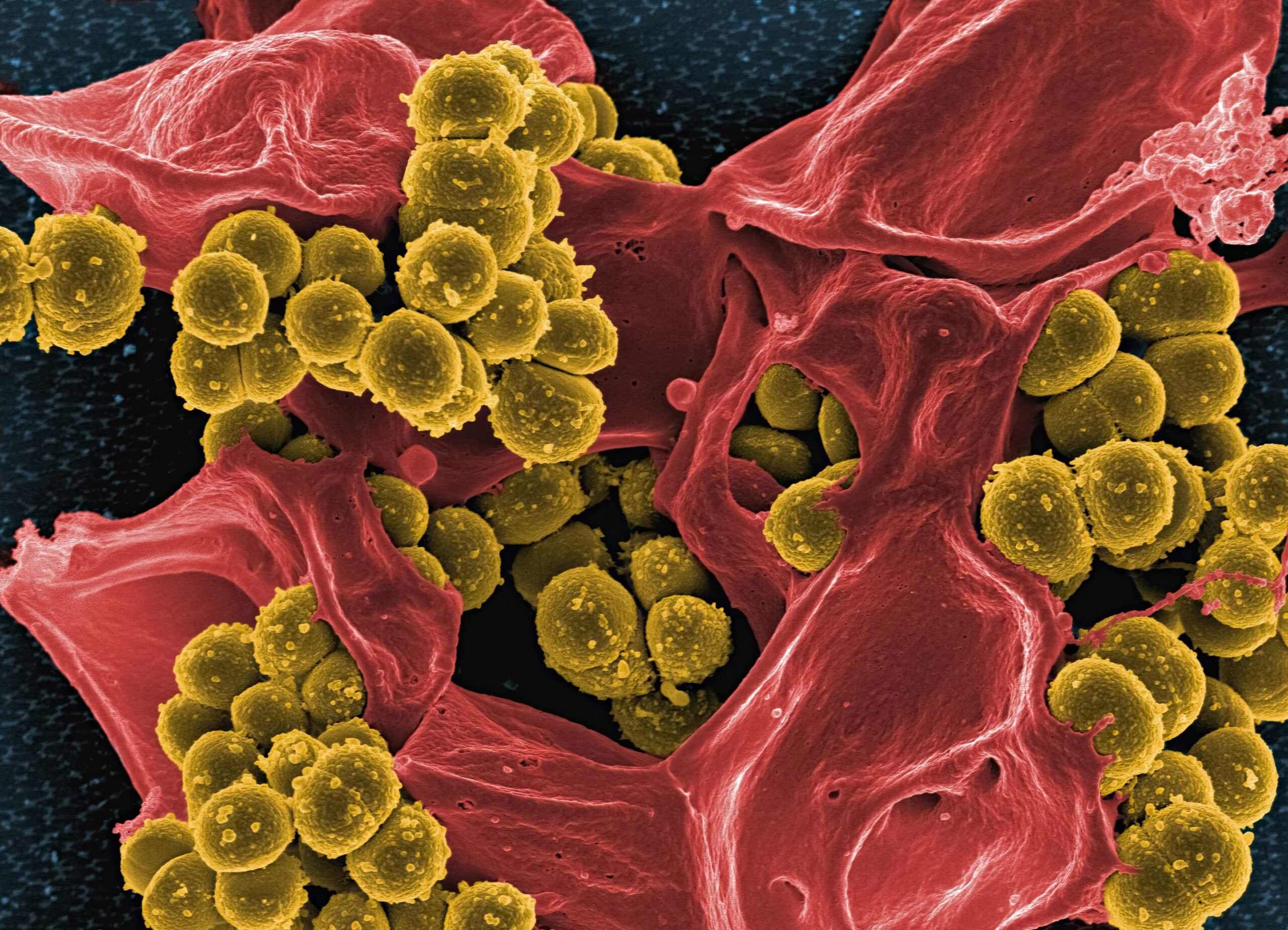 Image captured at NIAID's Rocky Mountain Laboratories (RML) in Hamilton, Montana. Credit: National Institute of Allergy and Infectious Diseases. Courtesy of Unsplash, Unsplash License, URL < national-institute-of-allergy-and-infectious-diseases-n36qXSkND8g-unsplash.jpg >